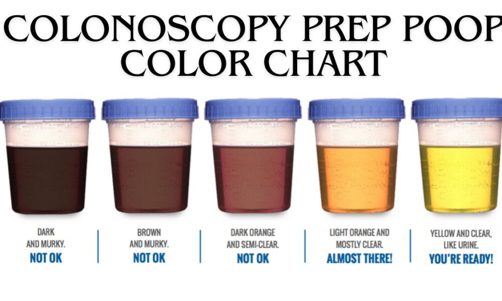 colonoscopy prep poop color chart