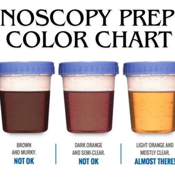 colonoscopy prep poop color chart